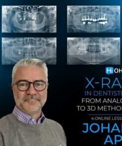 OHI-S X-ray in Dentistry: From Analog to 3D Methods