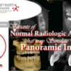 Variants of Normal Radiologic Anatomy that may Simulate Disease on Panoramic Images – Ernest Lam