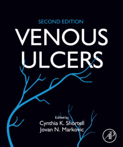 Venous Ulcers, 2nd Edition (EPUB)