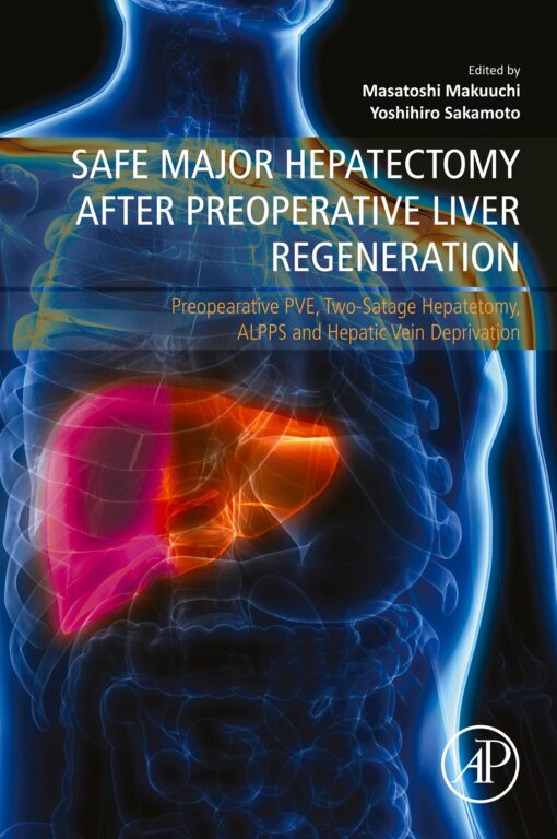 Safe Major Hepatectomy After Preoperative Liver Regeneration: Preopearative PVE, Two-Satage Hepatetomy, ALPPS And Hepatic Vein Deprivation (EPUB)