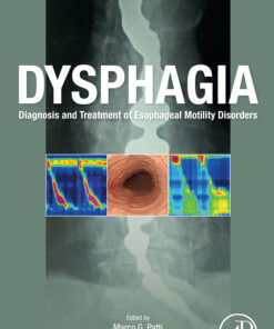 Dysphagia: Diagnosis And Treatment Of Esophageal Motility Disorders (PDF)