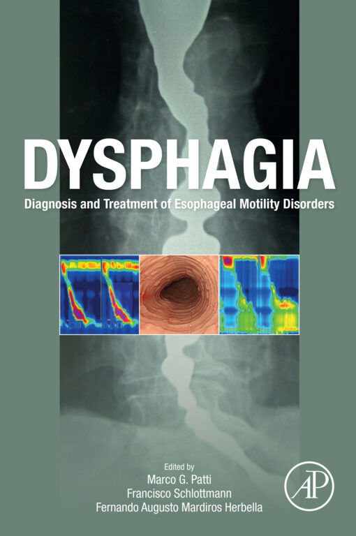 Dysphagia: Diagnosis And Treatment Of Esophageal Motility Disorders (PDF)