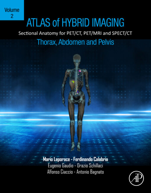 Atlas Of Hybrid Imaging Sectional Anatomy For PET/CT, PET/MRI And SPECT/CT Vol. 2: Thorax Abdomen And Pelvis: Sectional Anatomy For PET/CT, PET/MRI And SPECT/CT (EPUB)