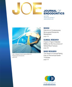 Journal of Endodontics PDF