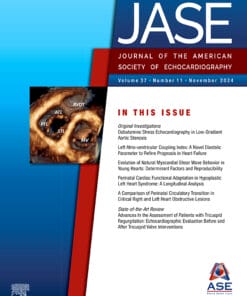 Journal of the American Society of Echocardiography PDF