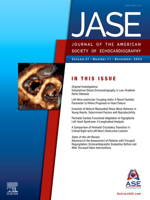 Journal of the American Society of Echocardiography PDF