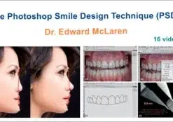 The Photoshop Smile Design Technique (PSD)