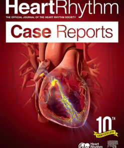 HeartRhythm Case Reports PDF