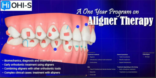 Anterior Implant Esthetic Restorations