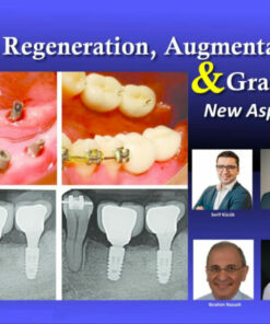 Bone Regeneration, Augmentation & Grafting, New Aspects