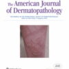 American Journal of Dermatopathology: Volume 44 (1 - 12) 2022 PDF