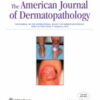 American Journal of Dermatopathology: Volume 45 (1 - 12) 2023 PDF