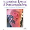 American Journal of Dermatopathology: Volume 45 (1 - 12) 2023 PDF