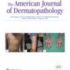 American Journal of Dermatopathology: Volume 45 (1 - 12) 2023 PDF