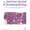 American Journal of Dermatopathology: Volume 45 (1 - 5) 2024 PDF