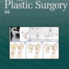 Annals of Plastic Surgery: Volume 90 (1 - 6) 2023 PDF