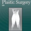 Annals of Plastic Surgery: Volume 90 (1 – 6) 2023 PDF