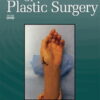 Annals of Plastic Surgery: Volume 91 (1 - 6) 2023 PDF