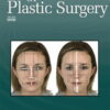 Annals of Plastic Surgery: Volume 91 (1 - 6) 2023 PDF