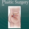 Annals of Plastic Surgery: Volume 91 (1 - 6) 2023 PDF