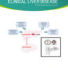 Clinical Liver Disease: Volume 20 (1 - 6) 2022 PDF