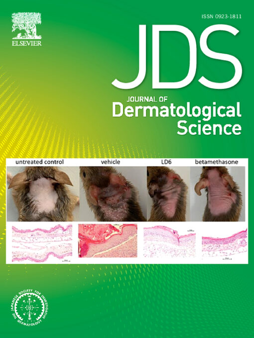 Journal of Dermatological Science PDF