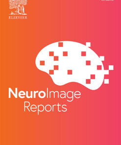 Neuroimage: Reports PDF