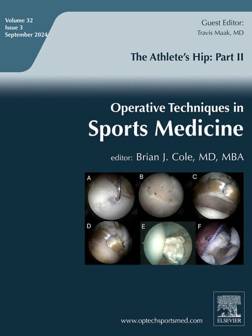 Operative Techniques in Sports Medicine PDF