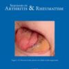 Seminars in Arthritis and Rheumatism: Volume 64 to Volume 65 2024 PDF