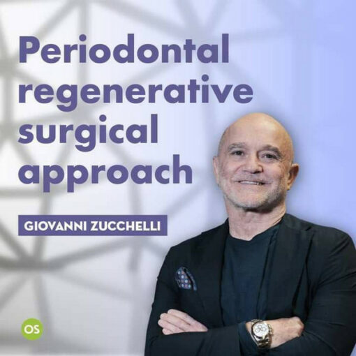 Periodontal Regenerative Surgical Approach (Video)