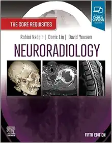 Neuroradiology: The Core Requisites, 5th Edition (PDF)