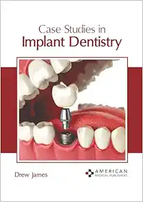 Case Studies In Implant Dentistry (PDF)