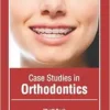 Case Studies In Orthodontics (PDF)