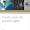 Cerebrovascular Neurosurgery (Neurosurgery By Example) (PDF)