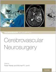 Cerebrovascular Neurosurgery (Neurosurgery By Example) (PDF)