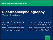 Electroencephalography: Textbook And Atlas (PDF)