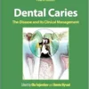 Dental Caries: The Disease And Its Clinical Management, 4th Edition (PDF)