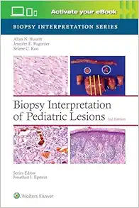 Biopsy Interpretation Of Pediatric Lesions, 2nd Edition (PDF)