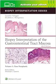 Biopsy Interpretation Of The Gastrointestinal Tract Mucosa Volume 1: Non-Neoplastic, 4ed (EPUB)