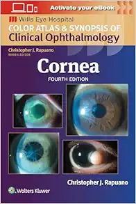 Cornea: Color Atlas And Synopsis Of Clinical Ophthalmology (Wills Eye Institute Atlas Series), 4ed (EPUB)