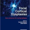 Focal Cortical Dysplasias: New Advances For Curing Epilepsy (PDF)