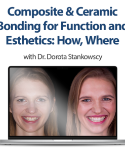 Composite & Ceramic Bonding for Function and Esthetics: How, Where & Why (2023)