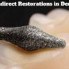 Indirect Restorations in Dentistry – A Complete Guide