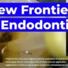 OHI-S New Frontiers in Endodontics