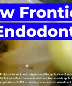 OHI-S New Frontiers in Endodontics