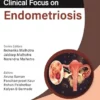 Clinical Focus On Endometriosis (PDF)