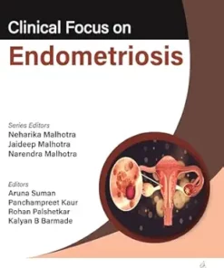 Clinical Focus On Endometriosis (PDF)