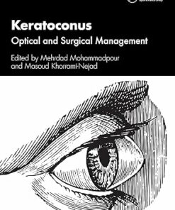 Keratoconus: Optical And Surgical Management (PDF)