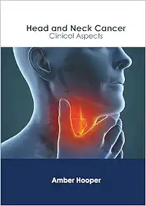 Head And Neck Cancer: Clinical Aspects (PDF)