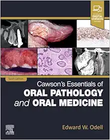 Cawson’s Essentials Of Oral Pathology And Oral Medicine, 10th Edition (PDF)